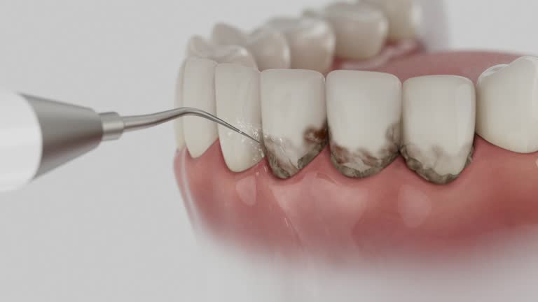 Reliable Dental contractor in Biddeford, ME by Smile Center Dentistry